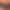 Patreon and Our Personal Story of Depression